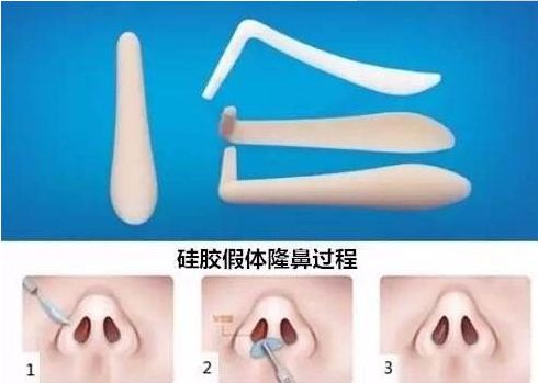 北京哪家醫(yī)院祛除眼袋效果最好？