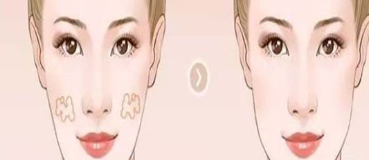 南京哪家醫(yī)院的小陰唇整形效果好？