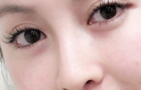 在烏魯木齊有哪些值得推薦的開眼角好醫(yī)院？