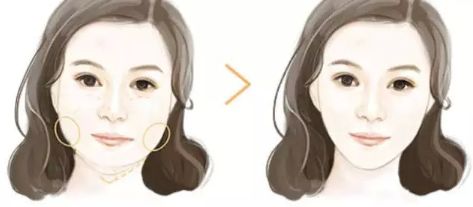上海哪家下頜骨醫(yī)院好？解析上海下頜骨疾病常見(jiàn)病例及專業(yè)治療！