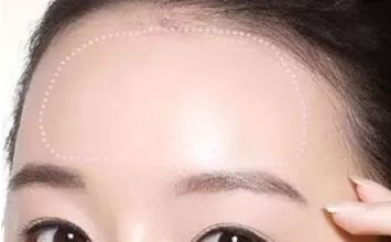 蘇州哪家黃褐斑醫(yī)院好？專業(yè)醫(yī)生推薦，讓你告別黃褐斑困擾！