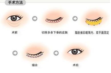 南寧治療痘印哪家醫(yī)院靠譜？—用戶首選南寧去痘印醫(yī)院排行榜