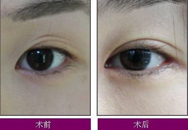 煙臺整疤痕哪家醫(yī)院好？了解煙臺整疤痕醫(yī)院的綜合評價和治療效果