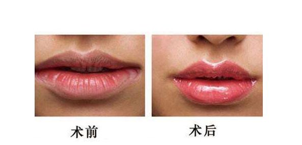 江蘇哪家醫(yī)院做激光祛斑好？