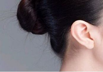鄭州趙麗做雙眼皮修復(fù)效果如何？整形醫(yī)生背景和坐診情況請(qǐng)看！