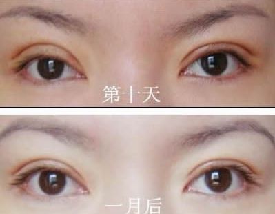 長春哪家醫(yī)院治痘痘好？了解長春市治療青春痘的?？漆t(yī)院及價(jià)格