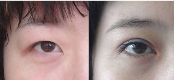 北京豐胸整形醫(yī)院哪家好？綜合評價和患者口碑推薦