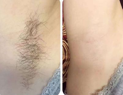 上海整形醫(yī)院哪家的好？最權(quán)威的排名榜單來幫你挑選！