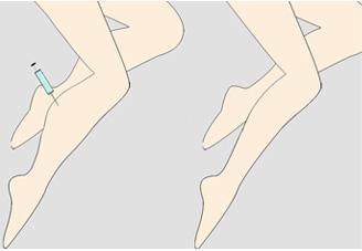 上海李昕醫(yī)生隆鼻技術(shù)實(shí)力有多強(qiáng)？揭秘國內(nèi)必備的一位鼻部整形專家