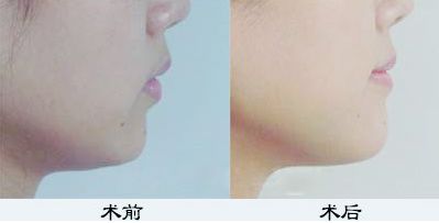 鄭州鼻綜合哪家醫(yī)院好？TOP醫(yī)療機(jī)構(gòu)大揭秘