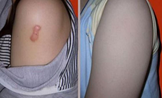 上海雙眼皮切開(kāi)手術(shù)，哪家醫(yī)院技術(shù)好且安全？