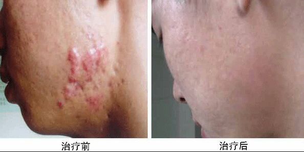 南京哪家醫(yī)院做兔唇手術(shù)效果好又安全？