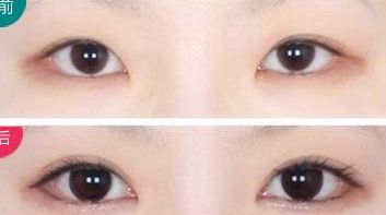 西安治療瘢痕哪家醫(yī)院好評不斷！