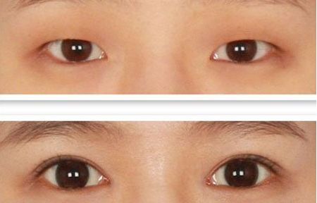 北京整容科好的醫(yī)院有哪些？中關(guān)村整形醫(yī)院綜合實(shí)力領(lǐng)先！
