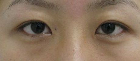 南寧哪家美容整形醫(yī)院口碑好又實惠？