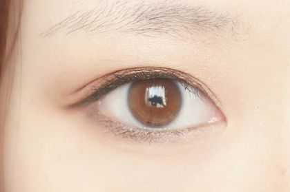 蕪湖伊萊美雙眼皮效果如何？有專家推薦嗎？