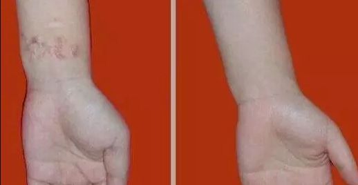 杭州哪家醫(yī)院看喉嚨好？排名最好的專業(yè)醫(yī)院推薦