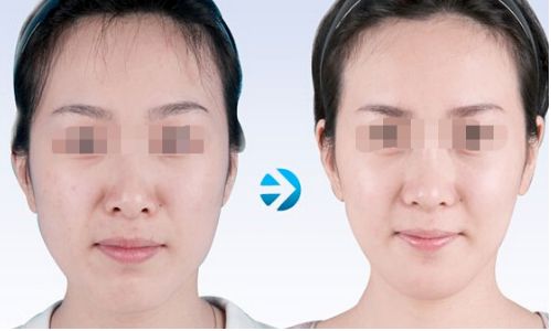 云南雙眼皮手術(shù)有哪些優(yōu)質(zhì)醫(yī)院值得推薦？