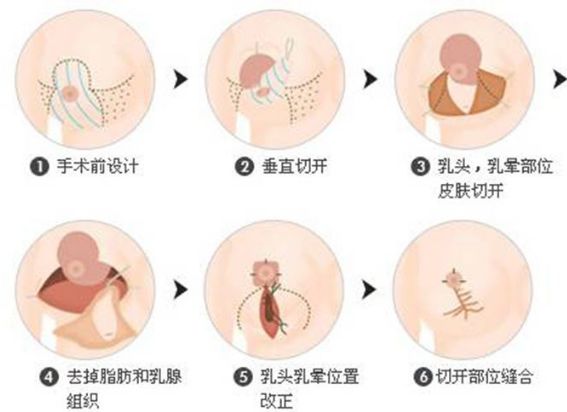 保定的整形醫(yī)院哪家好？全面解析保定整形醫(yī)院排名、口碑、專業(yè)團隊等
