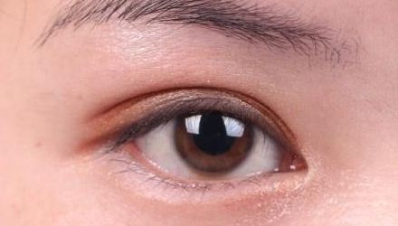 蘇州雙眼皮修復(fù)醫(yī)院排名及口碑，哪家醫(yī)院修復(fù)效果最好？