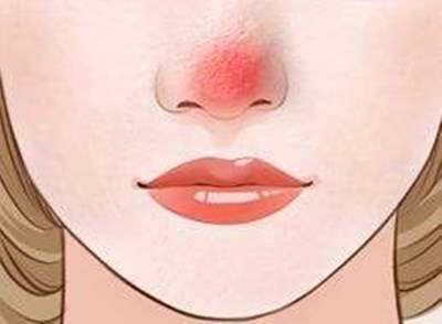 廣州最新開設的軍事美容整形醫(yī)院，王世虎是權威整形專家，手術價便宜