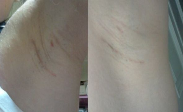 恩施地區(qū)有哪些信譽好的美容整形醫(yī)院？
