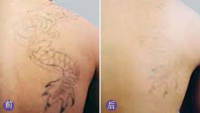 無錫哪家醫(yī)院眼科專業(yè)好？