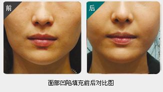 錦州整形美容醫(yī)院哪家靠譜？醫(yī)療技術(shù)如何？