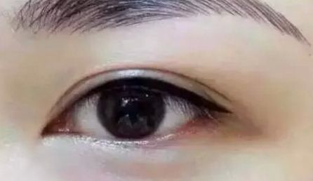 鄭州美麗時(shí)光醫(yī)療整形美容醫(yī)院費(fèi)用如何？評(píng)論怎么樣？整容前必讀！
