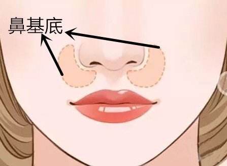 北京大學(xué)深圳醫(yī)院雙眼皮手術(shù)，何君君醫(yī)生口碑如何？資料公開！