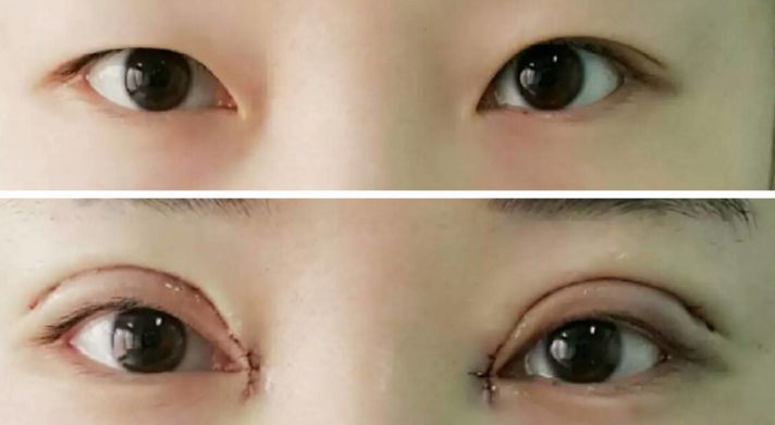 貴陽哪家醫(yī)院熱瑪吉效果好，值得推薦？