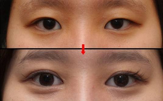 2023佛山大腿吸脂瘦腿專家評分前10強(qiáng)(謝漢平、曹碧浪、佛山曙光金子劉云忠龍頭地位穩(wěn)固)
