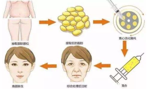 鄭州鼻整形哪家醫(yī)院好？一篇權(quán)威評(píng)測解答你的疑惑！