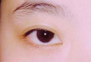 西安看胎記醫(yī)院哪家好？選擇胎記?？漆t(yī)院，專業(yè)技術(shù)得到用戶好評！