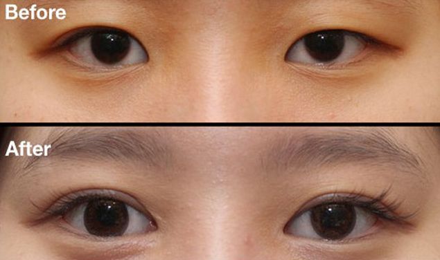 昆明刀疤修復(fù)哪家醫(yī)院好？挑選昆明專(zhuān)業(yè)刀疤修復(fù)醫(yī)院的技巧與要點(diǎn)