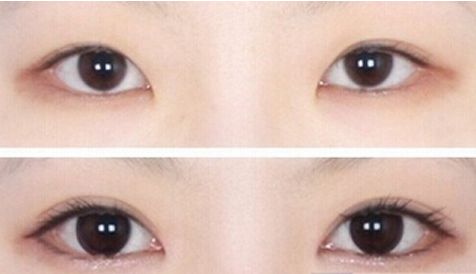 濟(jì)南哪家醫(yī)院的豐胸手術(shù)效果最好？