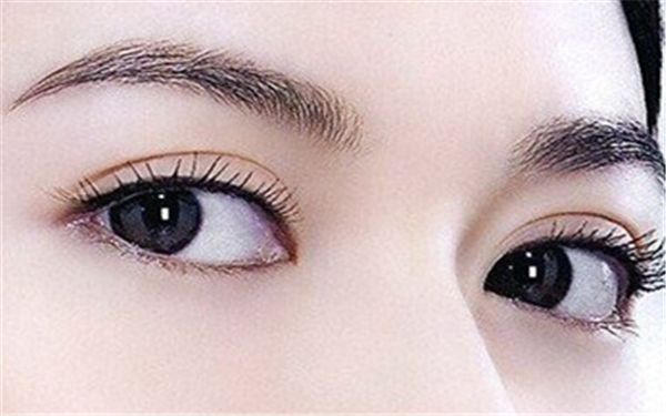如何選擇北京雙眼皮埋線哪家好？細(xì)致評級幫您快速決策！
