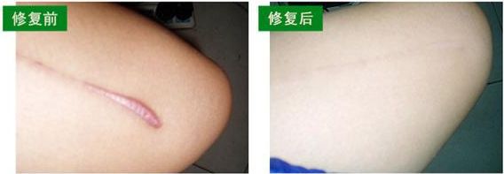 新鄉(xiāng)市眼袋手術(shù)哪家好？選擇新鄉(xiāng)市口碑最佳的眼袋手術(shù)醫(yī)院