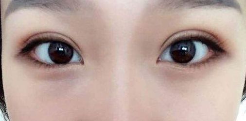 永州地區(qū)哪家正規(guī)整形醫(yī)院好？
