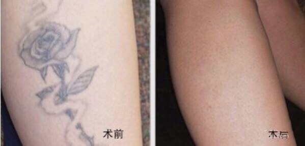 不二選擇！上海鼻修復(fù)專家徐永豐、劉仁輝搶占熱門名單成功！個(gè)人實(shí)力攀升不可阻擋！