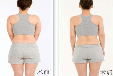 杭州哪家祛痘醫(yī)院好？綜合評(píng)測(cè)幫你選擇！