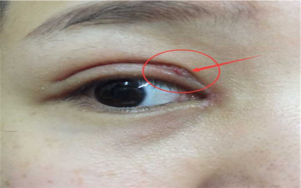 蘇州隆胸哪家醫(yī)院好？專業(yè)醫(yī)師為您分析