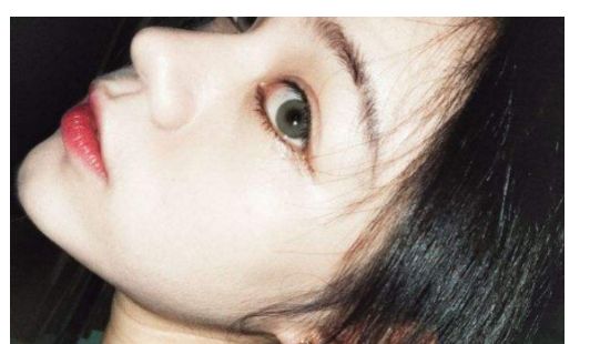 找一家靠譜的汕頭去除疤痕醫(yī)院？看這里！