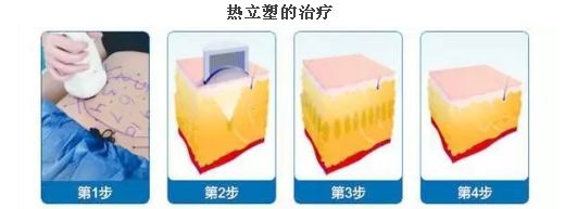上海臉部祛斑哪家醫(yī)院好？揭秘上海市最受歡迎臉部祛斑醫(yī)院排行榜