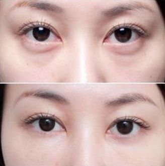 杭州厚唇變薄醫(yī)院哪家好？