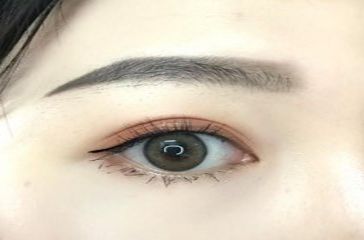 上海去黑眼圈哪個醫(yī)院好？專家推薦的實力醫(yī)院排行榜