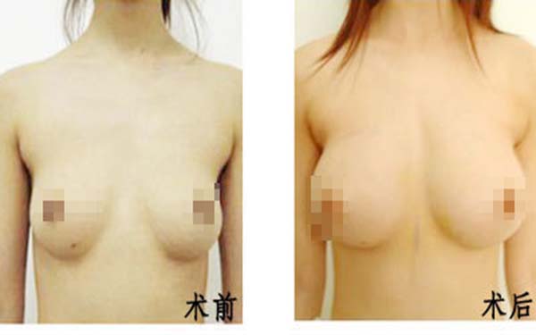 朱海杰鼻部整形效果如何？醫(yī)生評(píng)價(jià)+就診醫(yī)院匯總+價(jià)格信息參考