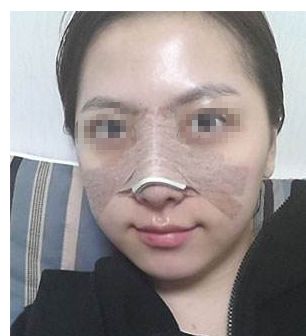 告別私處暗沉！盡顯白皙嬌嫩，激光漂紅來一次就有效果嗎？巧妙俘獲男人的心！