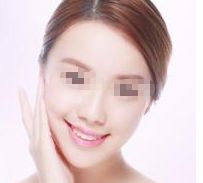 恢復(fù)女性魅力，重塑挺翹胸部的矯正方法