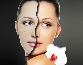 北京雙眼皮修復(fù)的效果如何？什么狀況需要做雙眼皮修復(fù)？